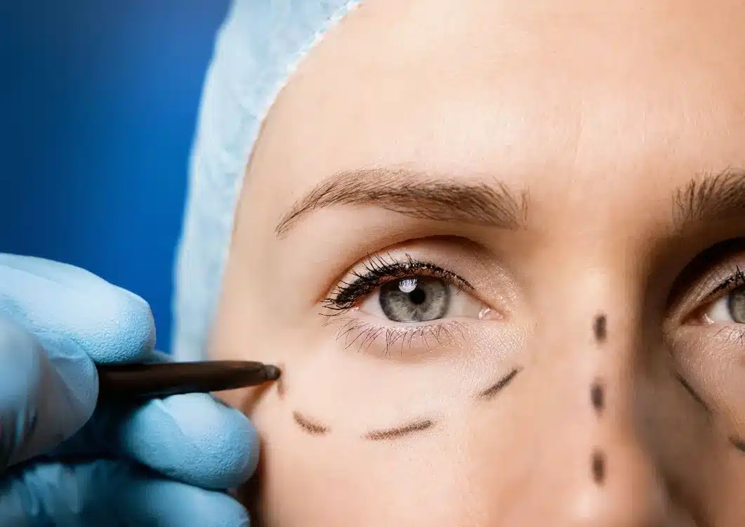 Why Patients Choose the Center for Excellence in Eye Care